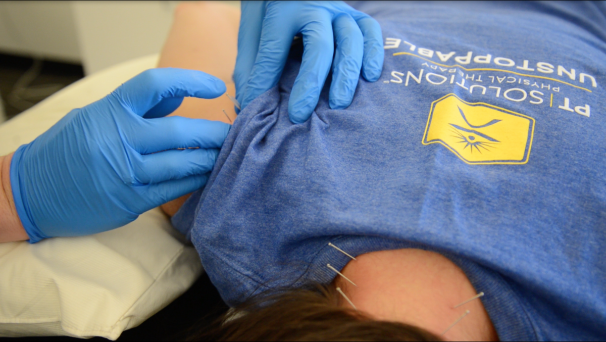 Pt Solutions Physical Therapists Are Certified Dry Needling Experts